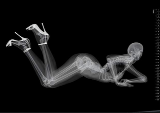 Illustration for article titled X-Ray Console Quiz!